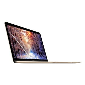 Защитная пленка LENTION для MacBook 12" - Фото 2