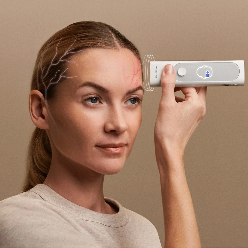 Пристрій 4-в-1 для домашнього медичного огляду Withings BeamO